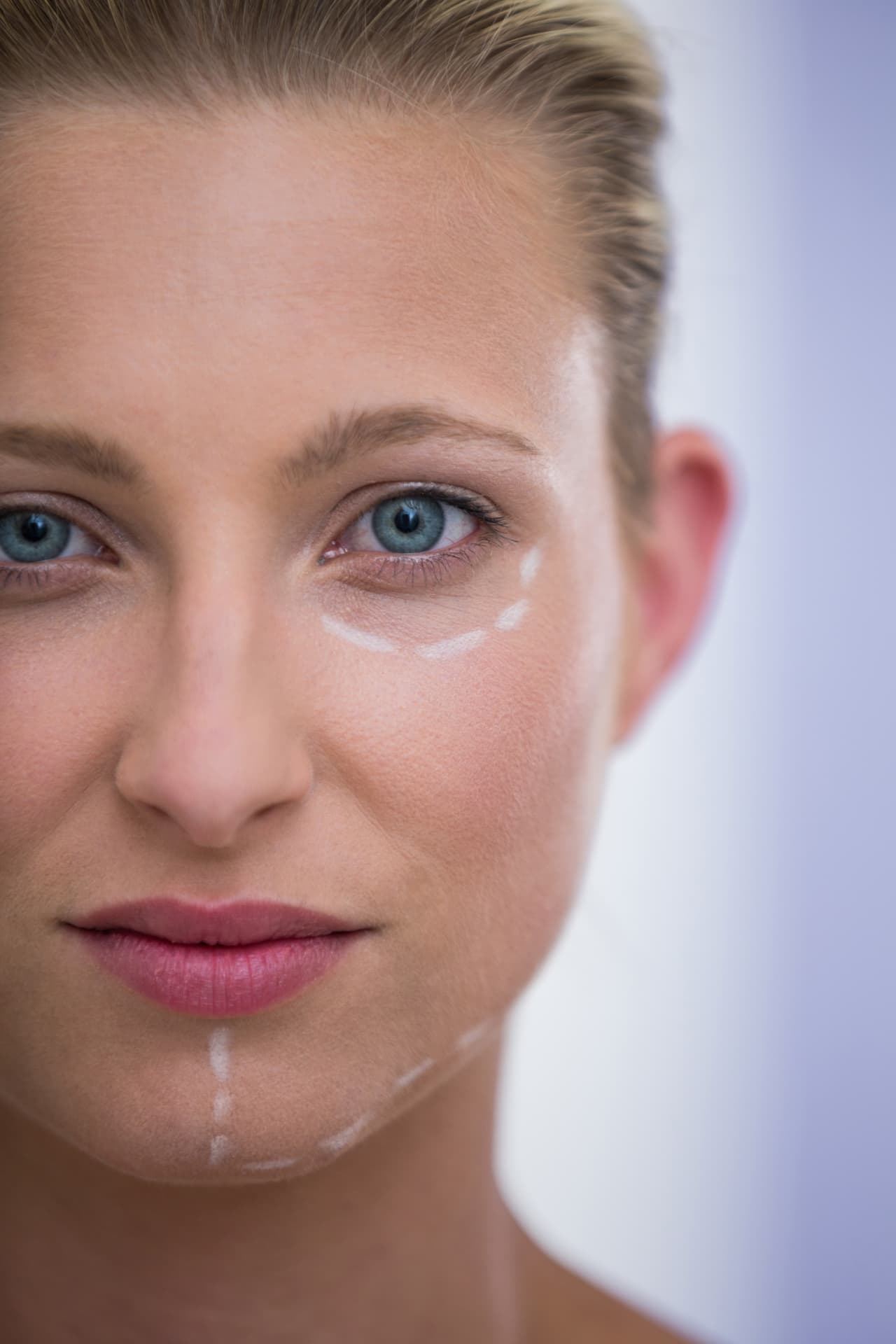 Rosto feminino em close com marcações de planejamento facial